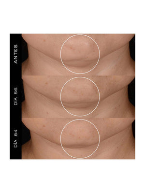 Rénergie H.P.N 300 -Peptide Cream